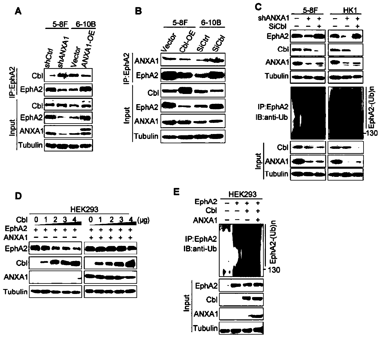 ANXA1 derived polypeptide and application thereof