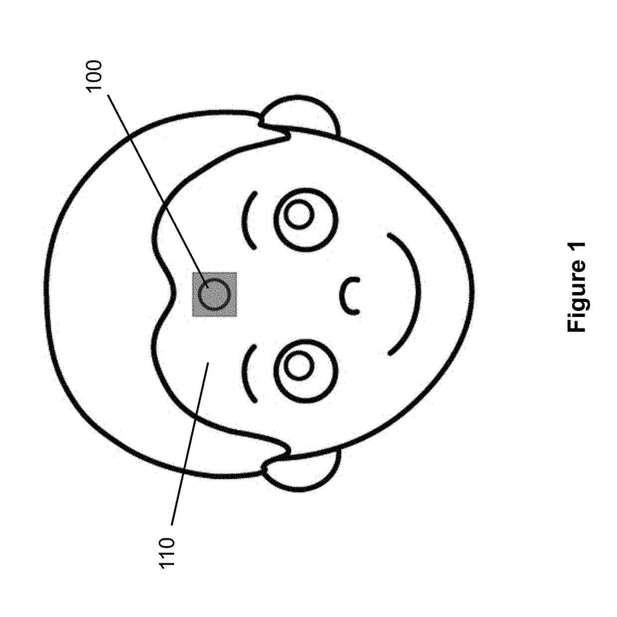 Wearable thermometer patch for accurate measurement of human skin temperature