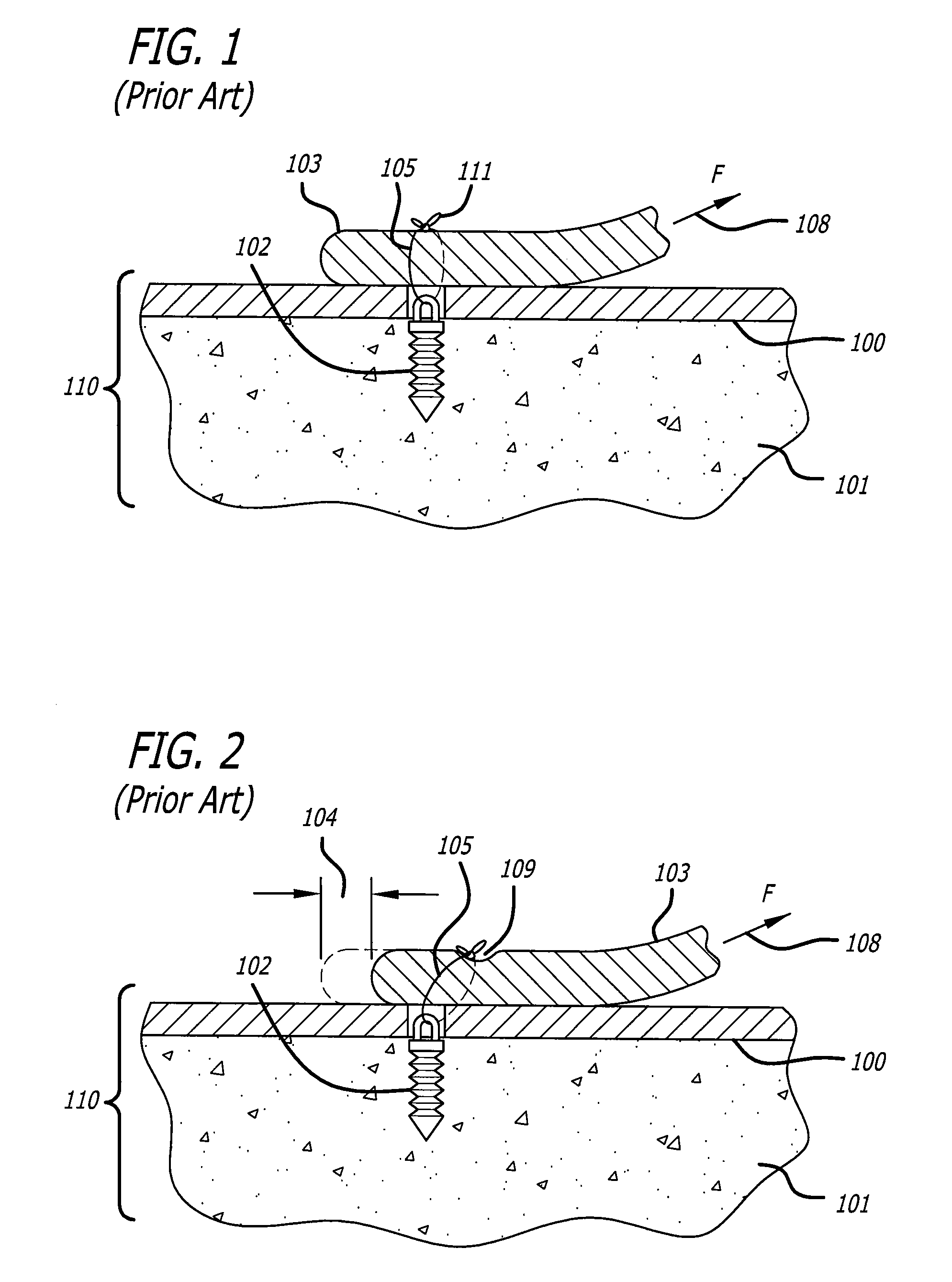 Insertion tool for knotless suture anchor for soft tissue repair and method of use