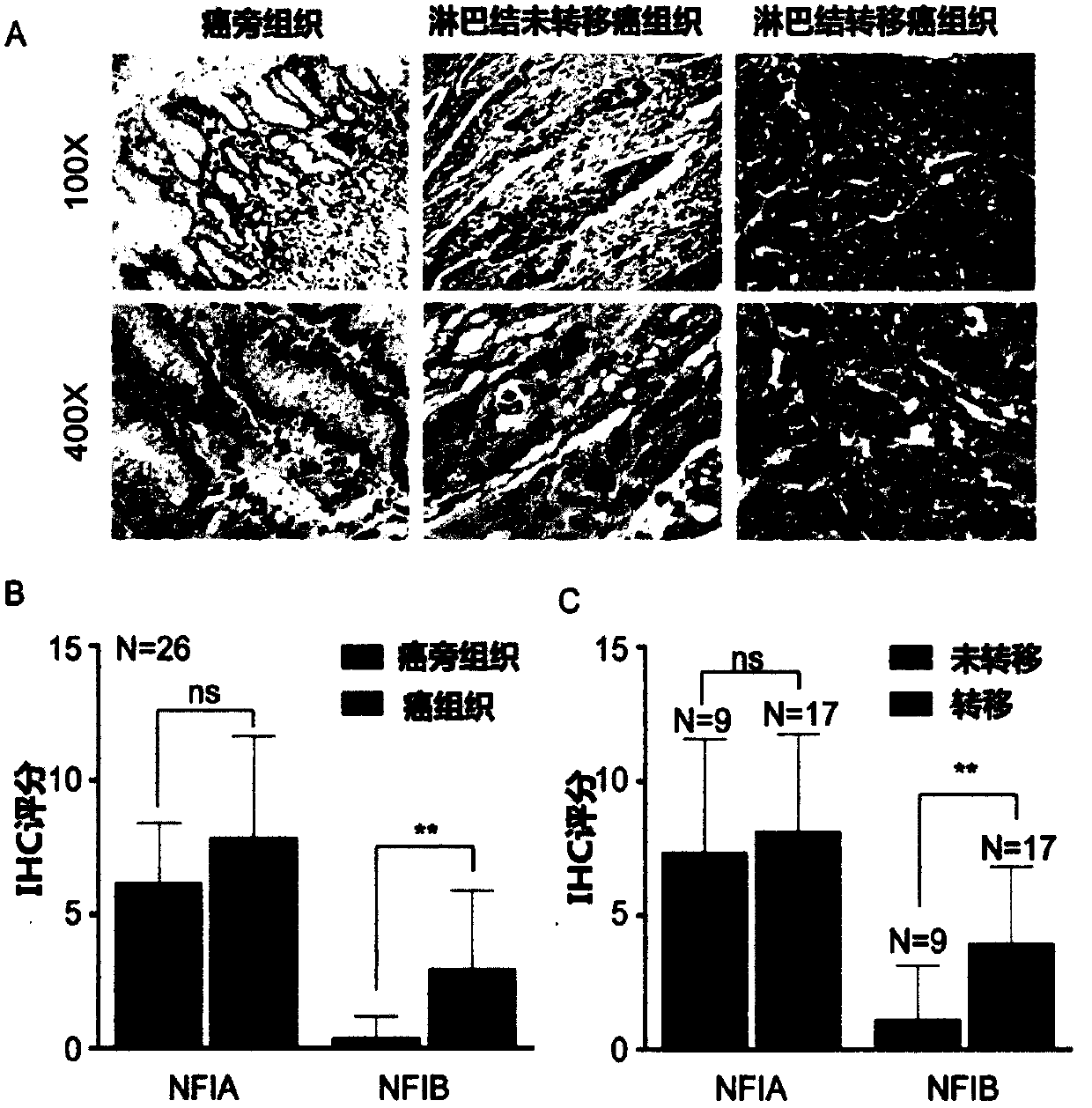 Oesophagogastric junction adenocarcinoma related biomarker and application thereof