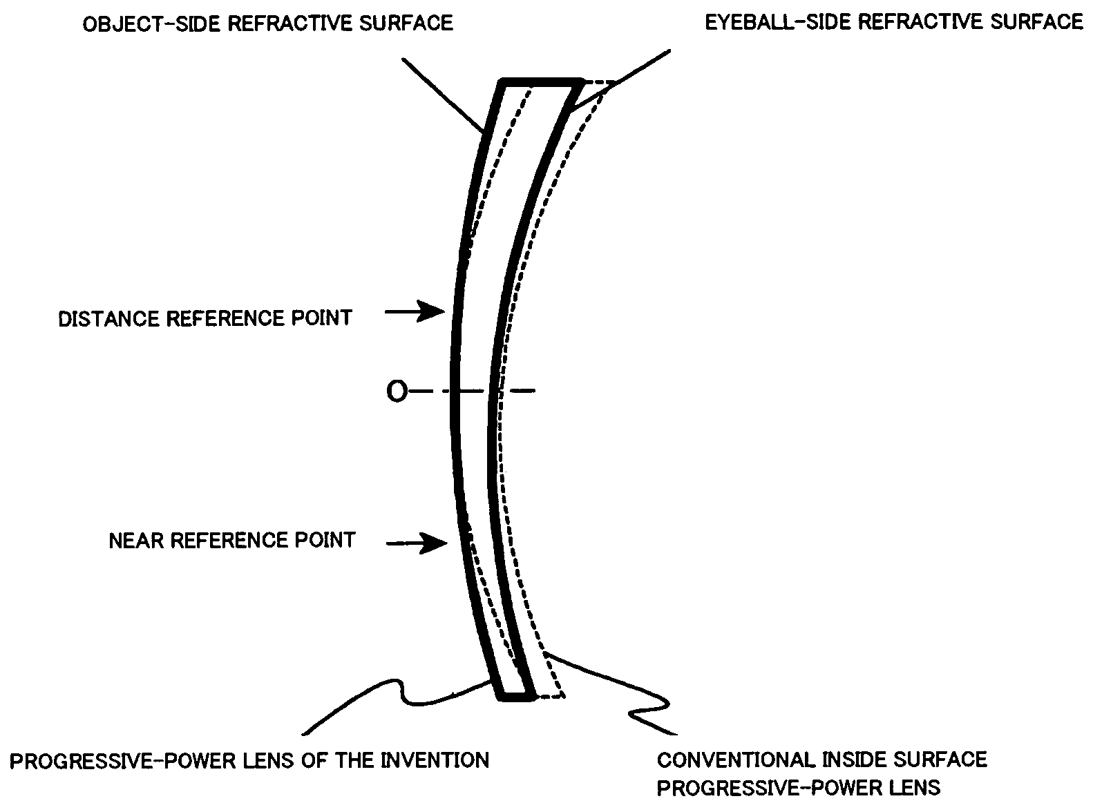 Progressive refractive power lens