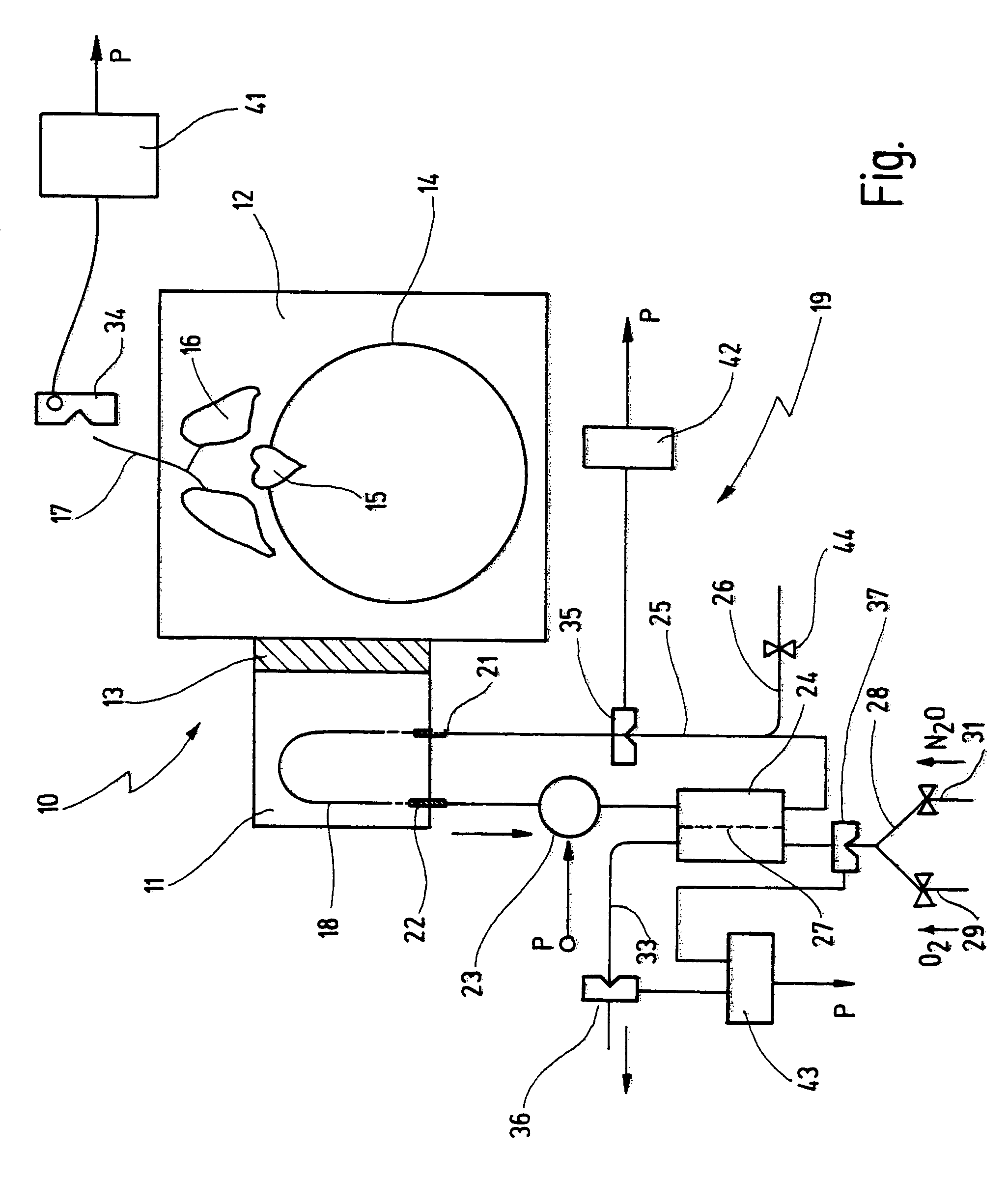 Device and method for establishing an artificial isolated circulation in a target area of a human or animal body