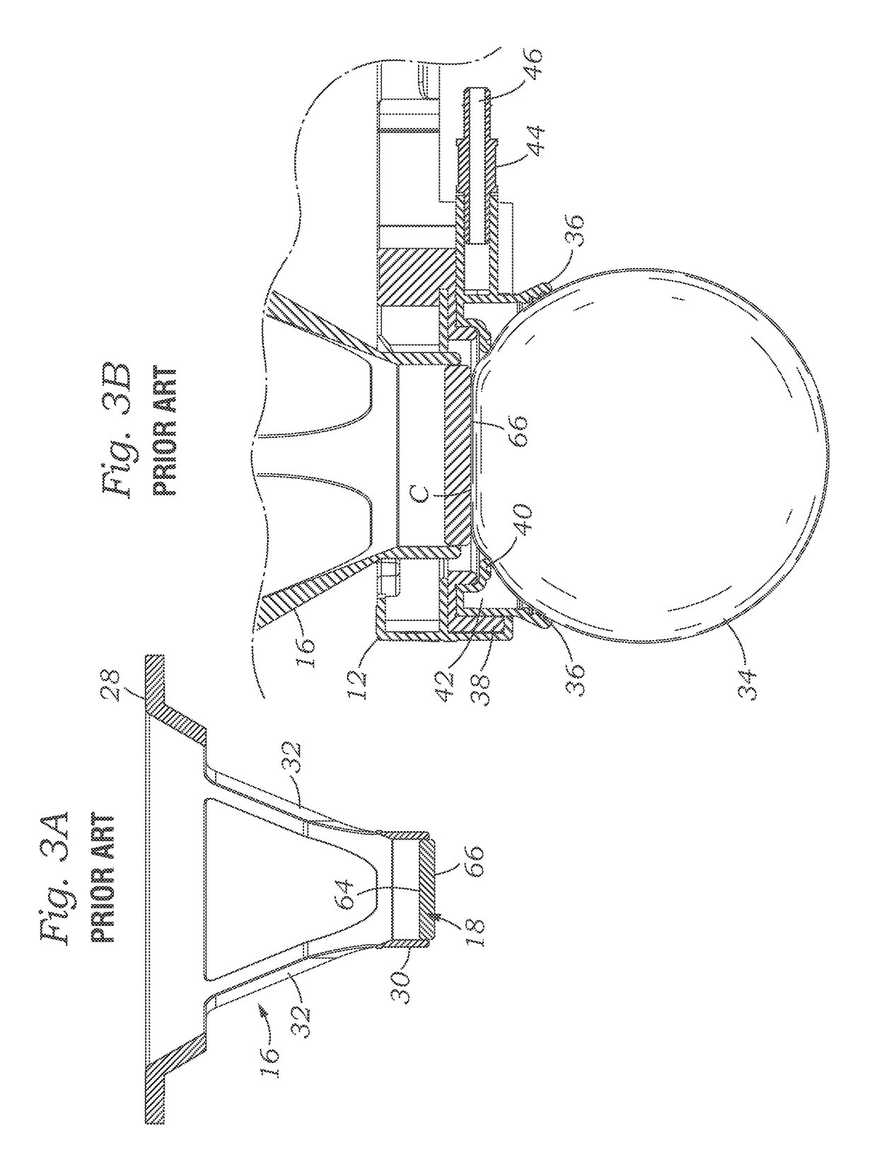 Hybrid ophthalmic interface apparatus