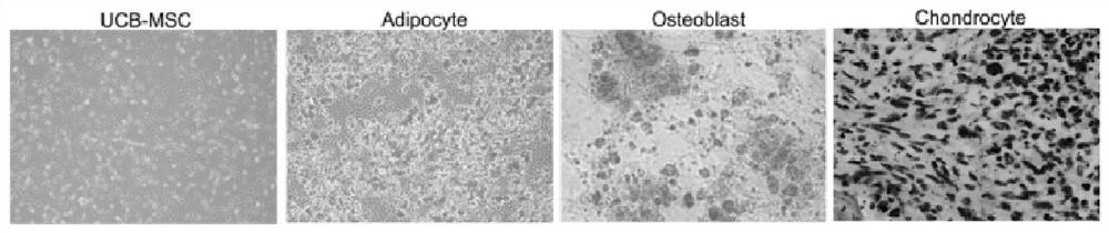 Mesenchymal stem cell strain for overexpression of PD-L1 gene as well as a construction method and application of mesenchymal stem cell strain