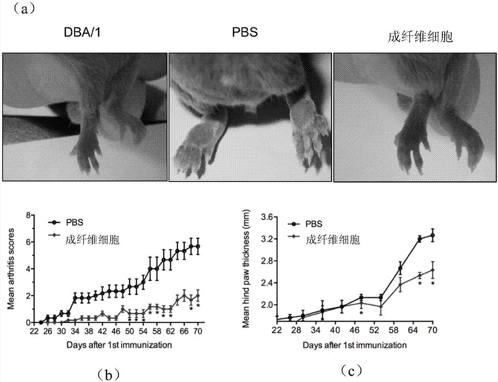 Application of human synovial membrane fibroblasts to treating rheumatoid arthritis