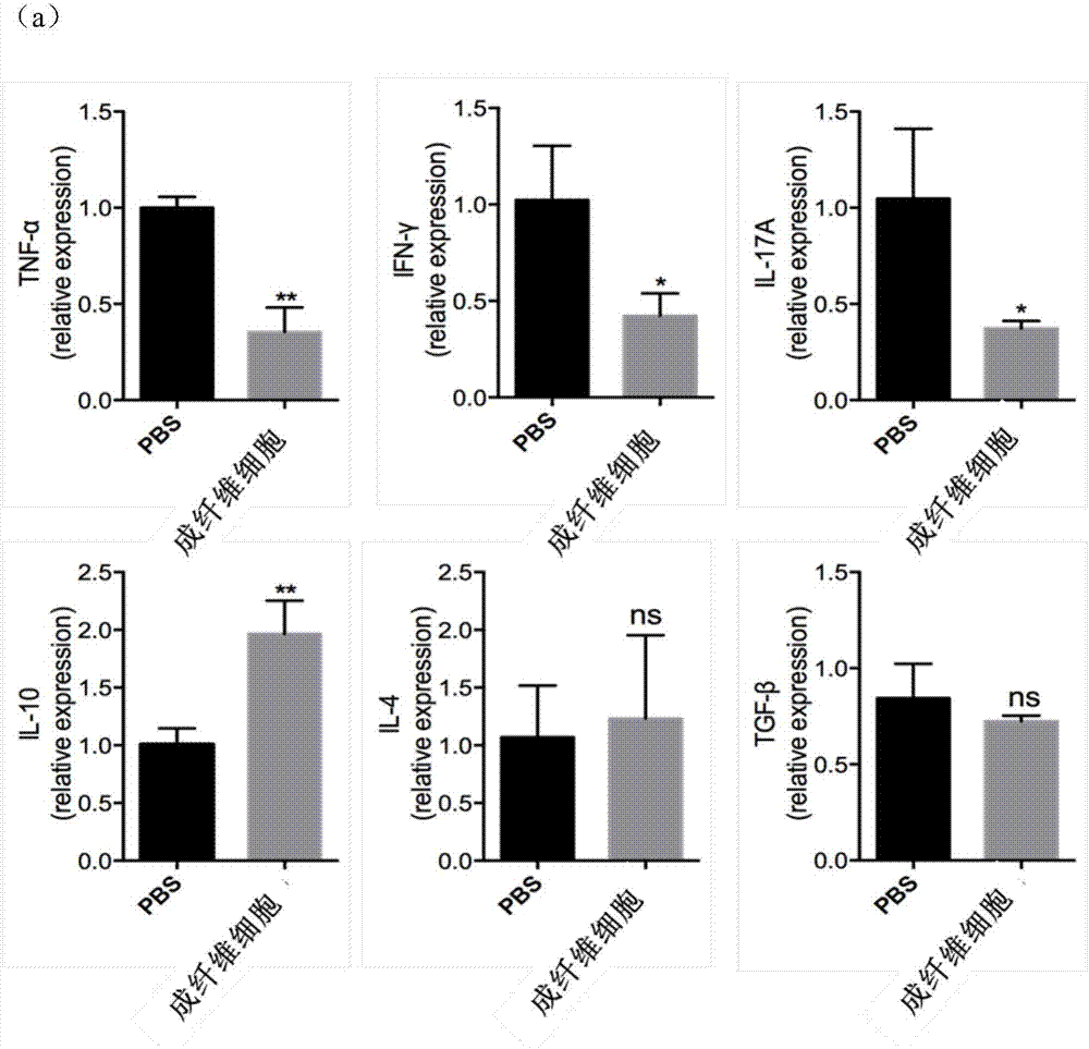 Application of human synovial membrane fibroblasts to treating rheumatoid arthritis