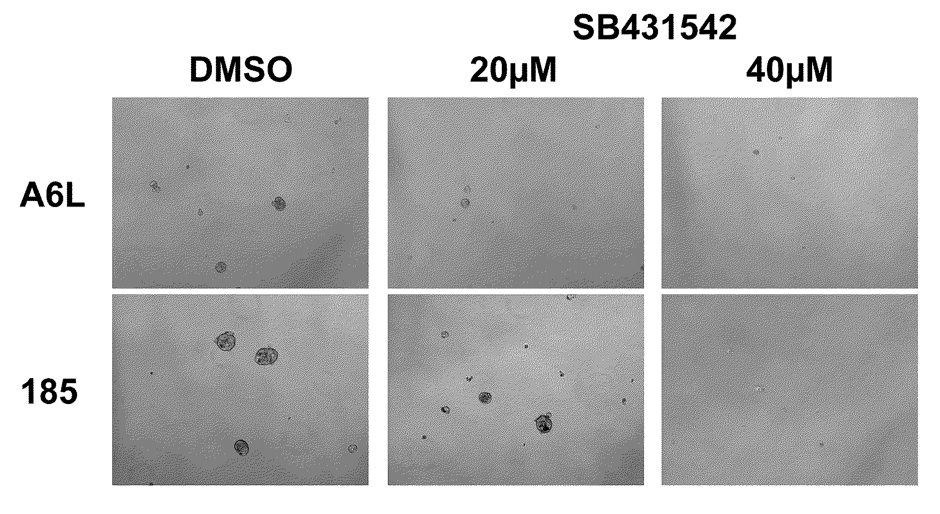 Active substance combination with gemcitabine for the treatment of epithelial cancer