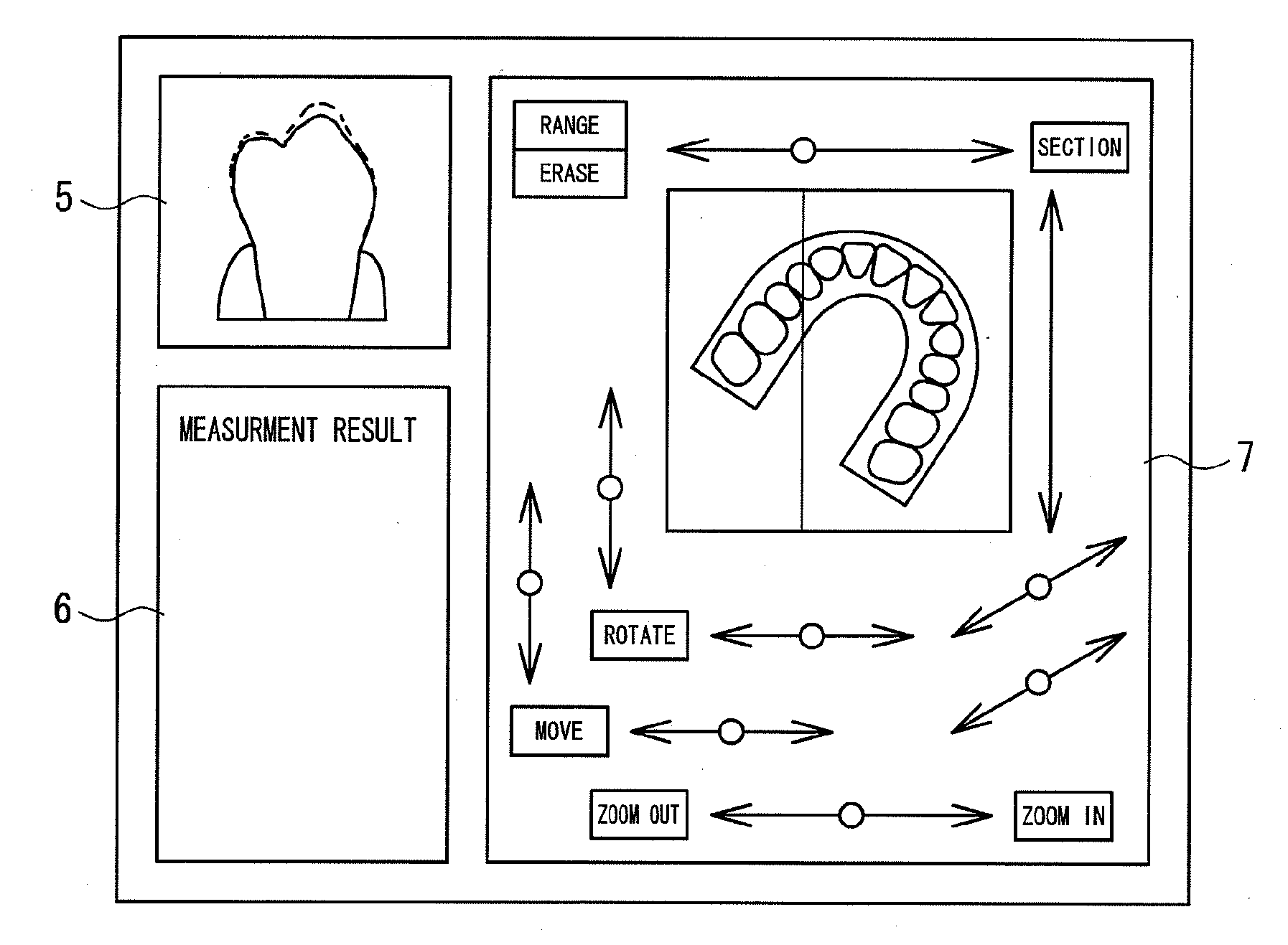 Occlusal wear evaluation apparatus and occlusal wear evaluation method