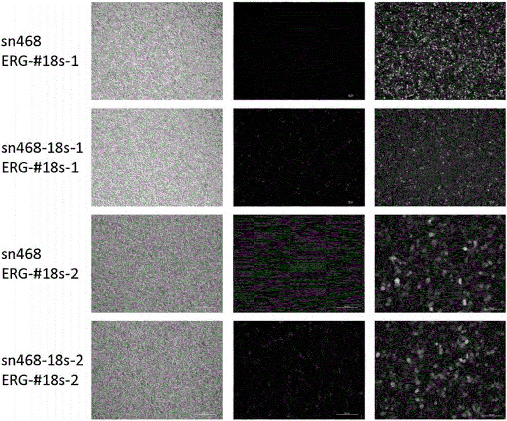 Method for targeted editing of buffalo 18S rDNA gene by virtue of adenovirus system