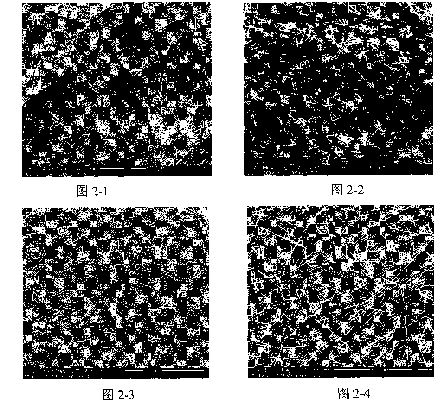 Degradable submicron fiber membrane for postoperative adhesion prevention and preparation thereof