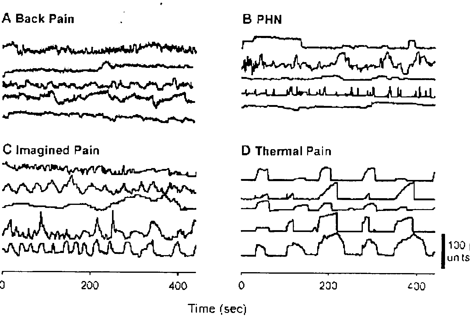 Apparatus and method for pain measurement