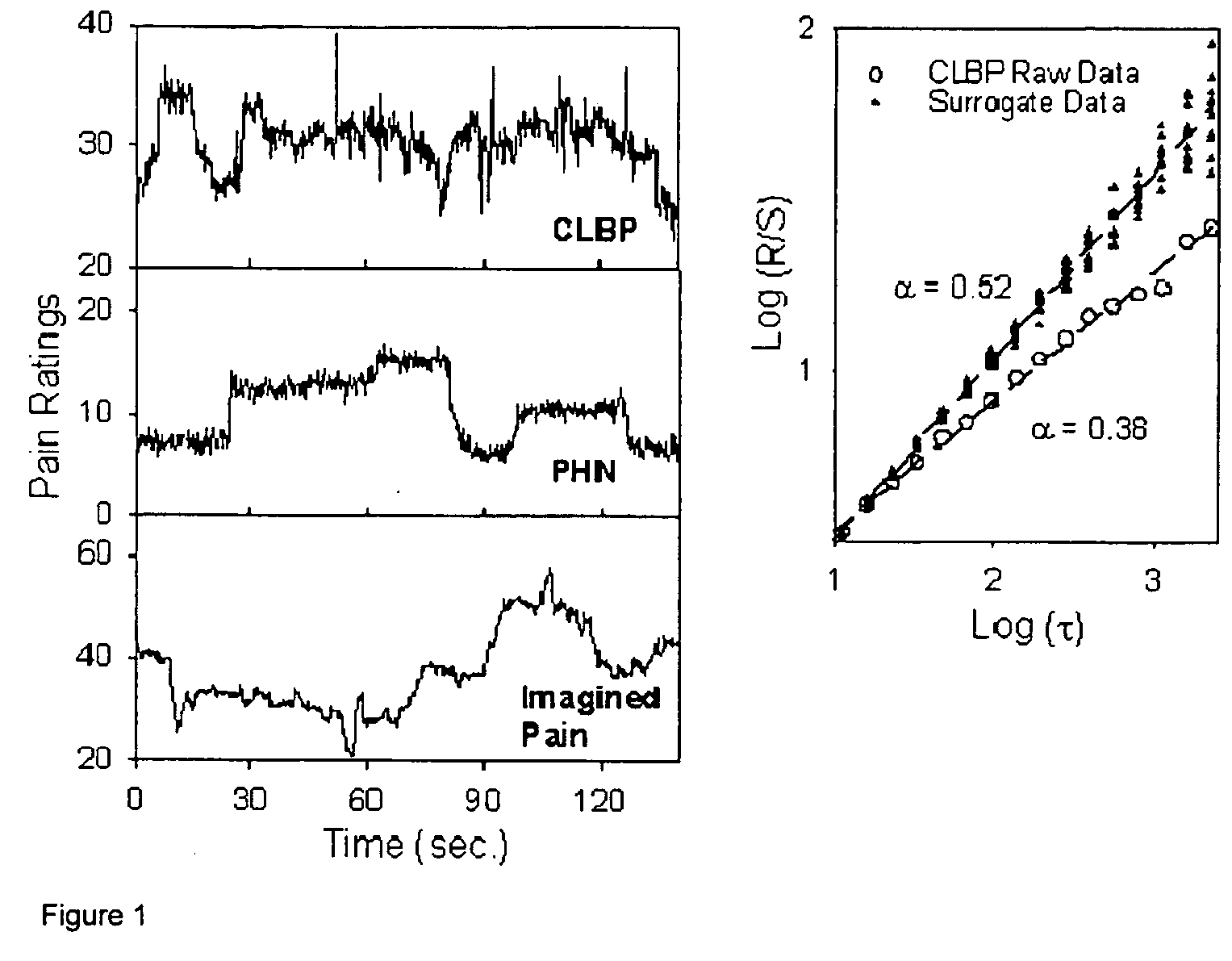 Apparatus and method for pain measurement