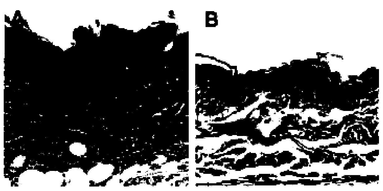 Anti-inflammatory composition and anti-inflammatory product prepared therefrom and application thereof