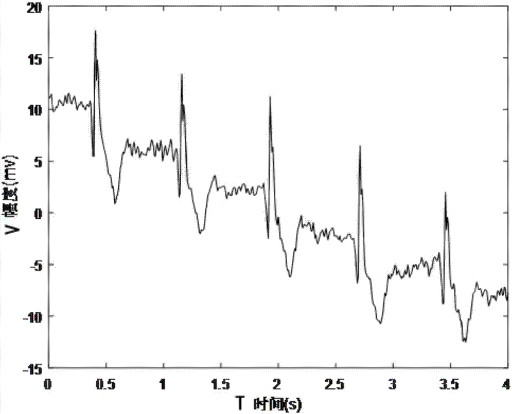 Motion state heart rate processing method and monitoring device