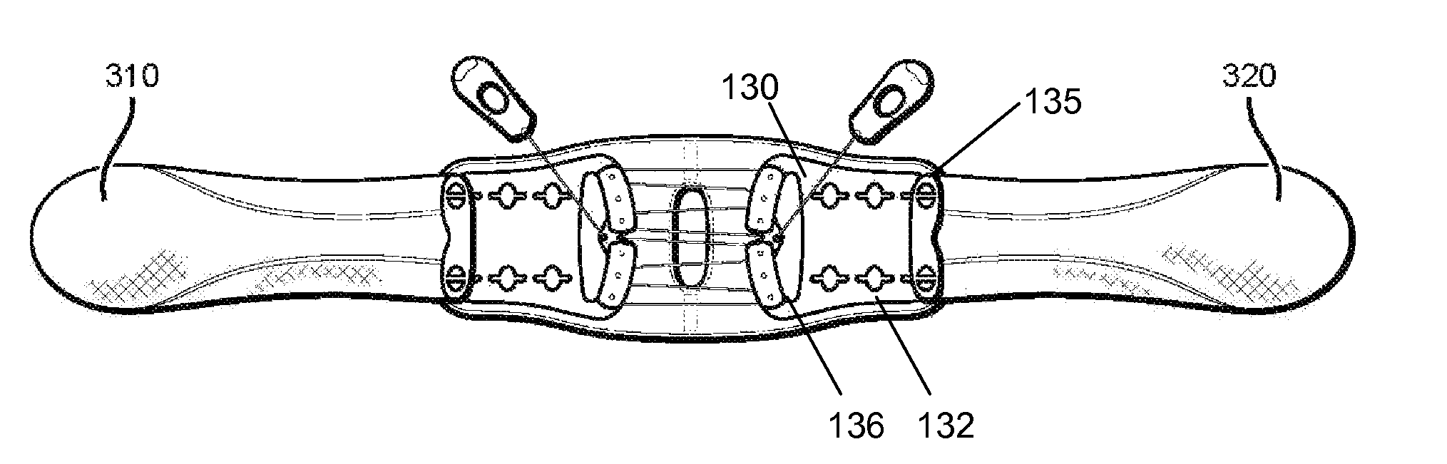 Highly adjustable lumbar brace