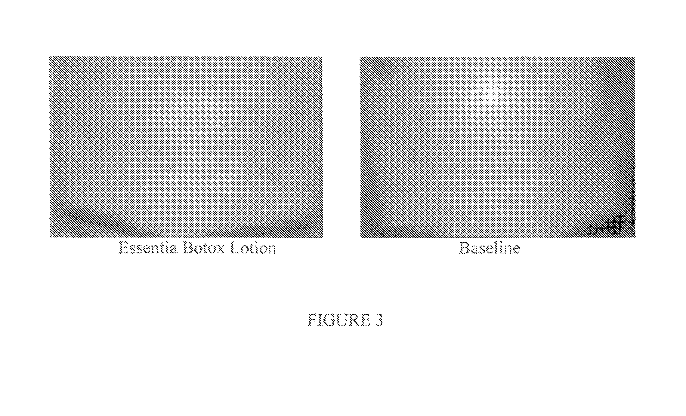 Compositions and Methods for Topical Application and Transdermal Delivery of Botulinum Toxins