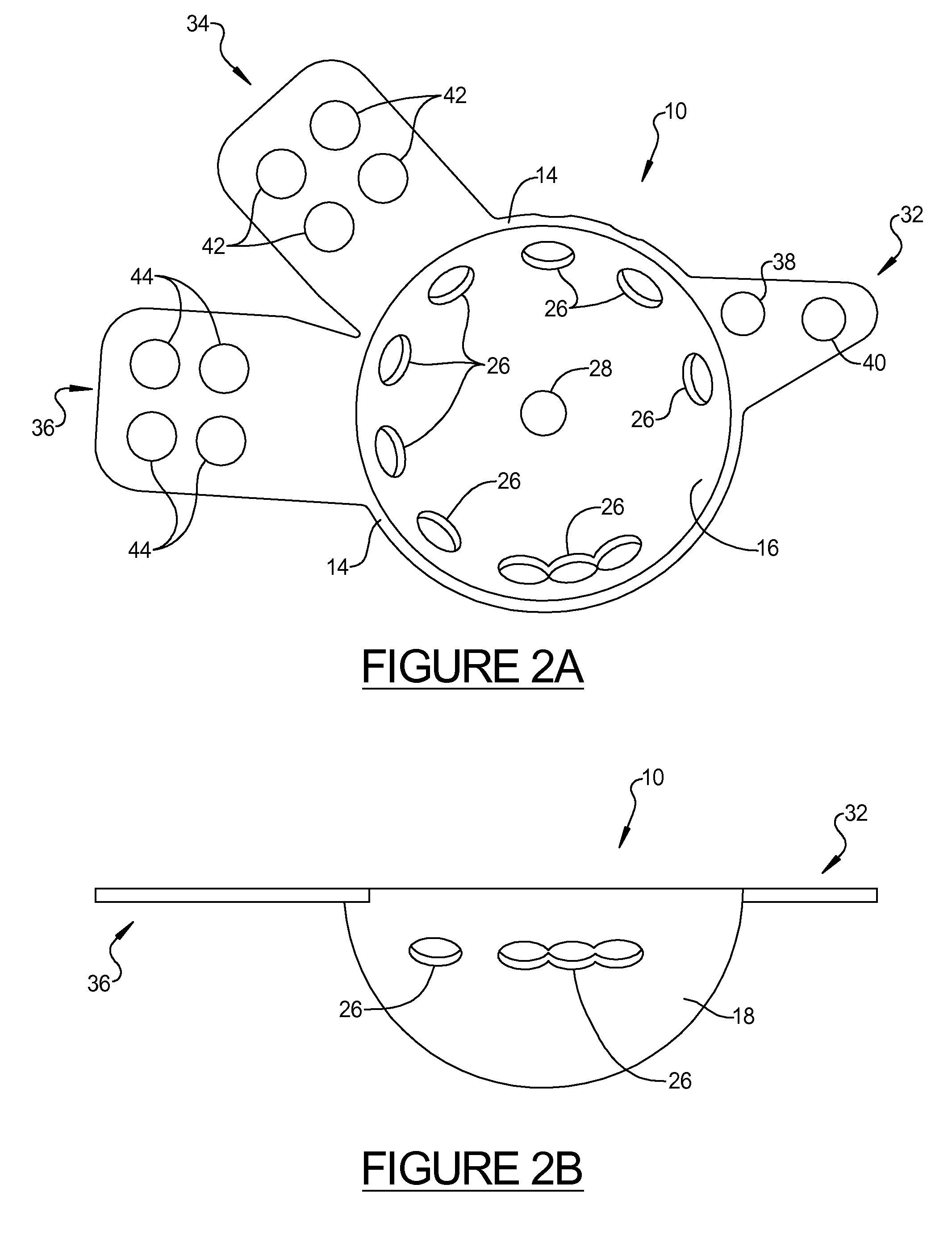 Acetabular Prosthesis