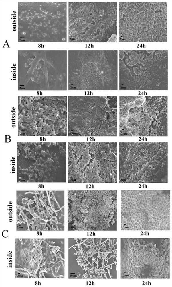 Medical composite nanofiber dressing as well as preparation method and application thereof