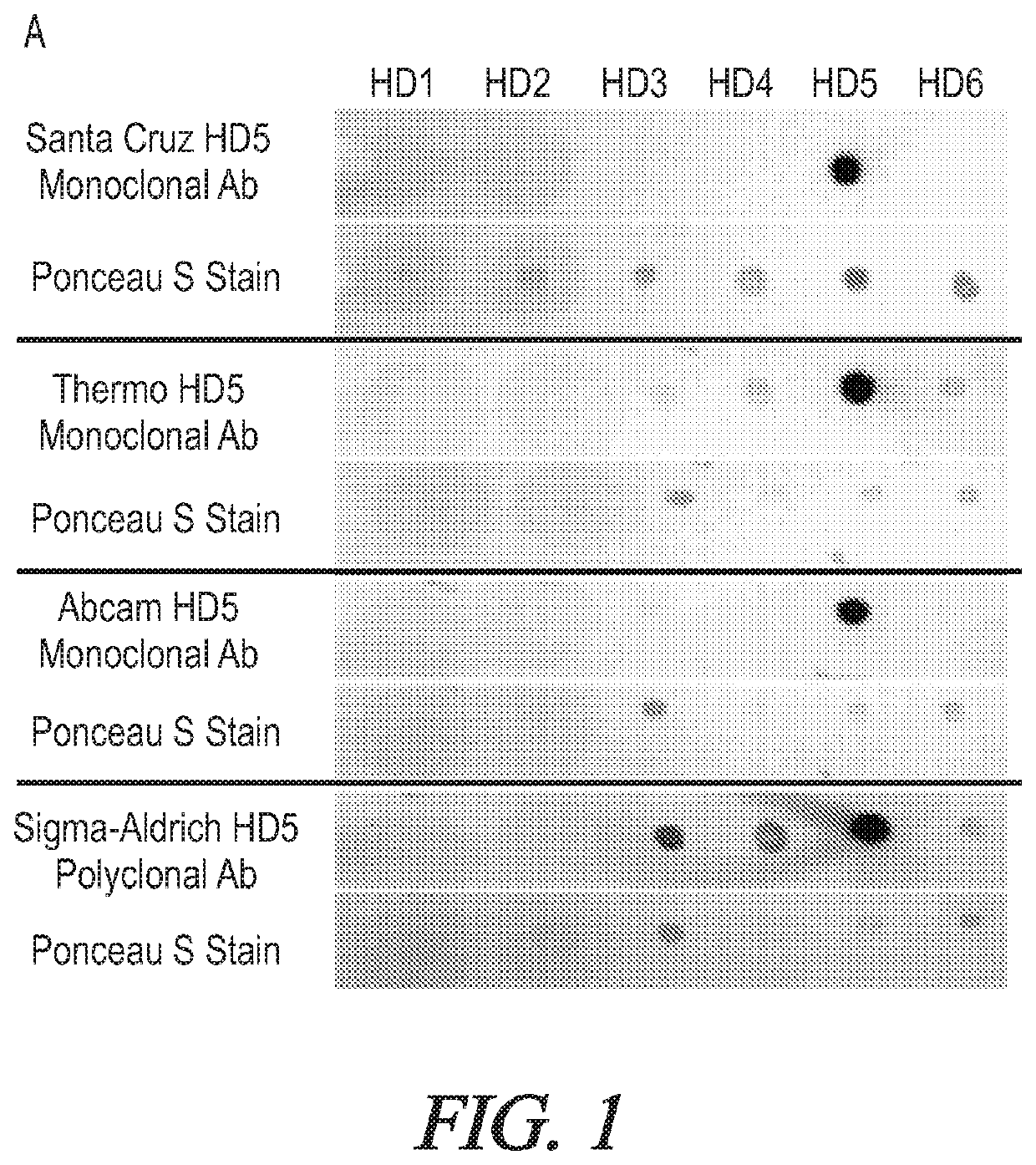 Targeted hd5 antibody and assay methods for diagnosing and treating inflammatory bowel disease