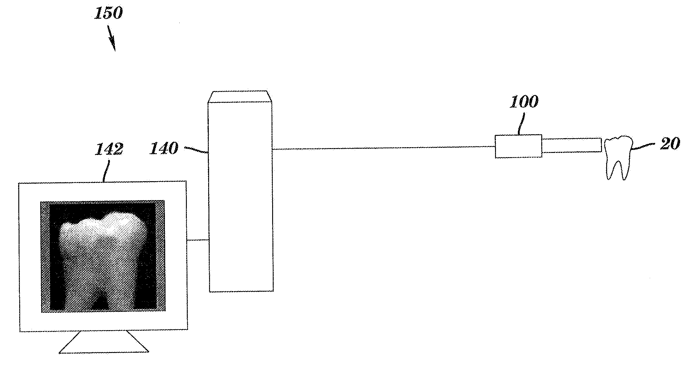 Intra-oral camera for diagnostic and cosmetic imaging