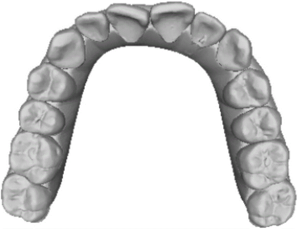 Collision detection algorithm for calculating occlusion areas of upper and lower jaws