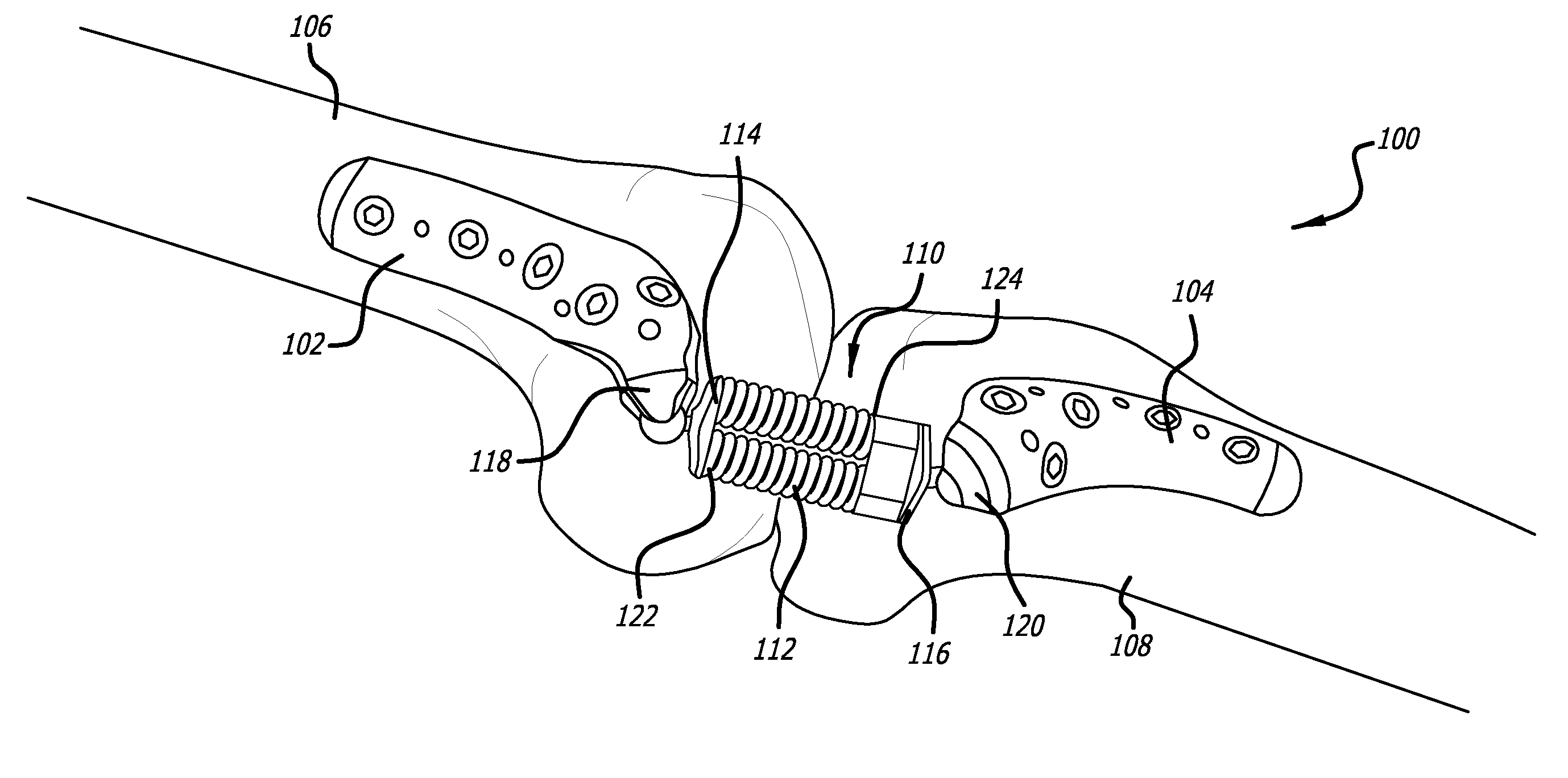 Adjustable absorber designs for implantable device