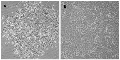 Cell line for conditional induced knockout of mouse spermatogonia Tet3 gene and construction method thereof