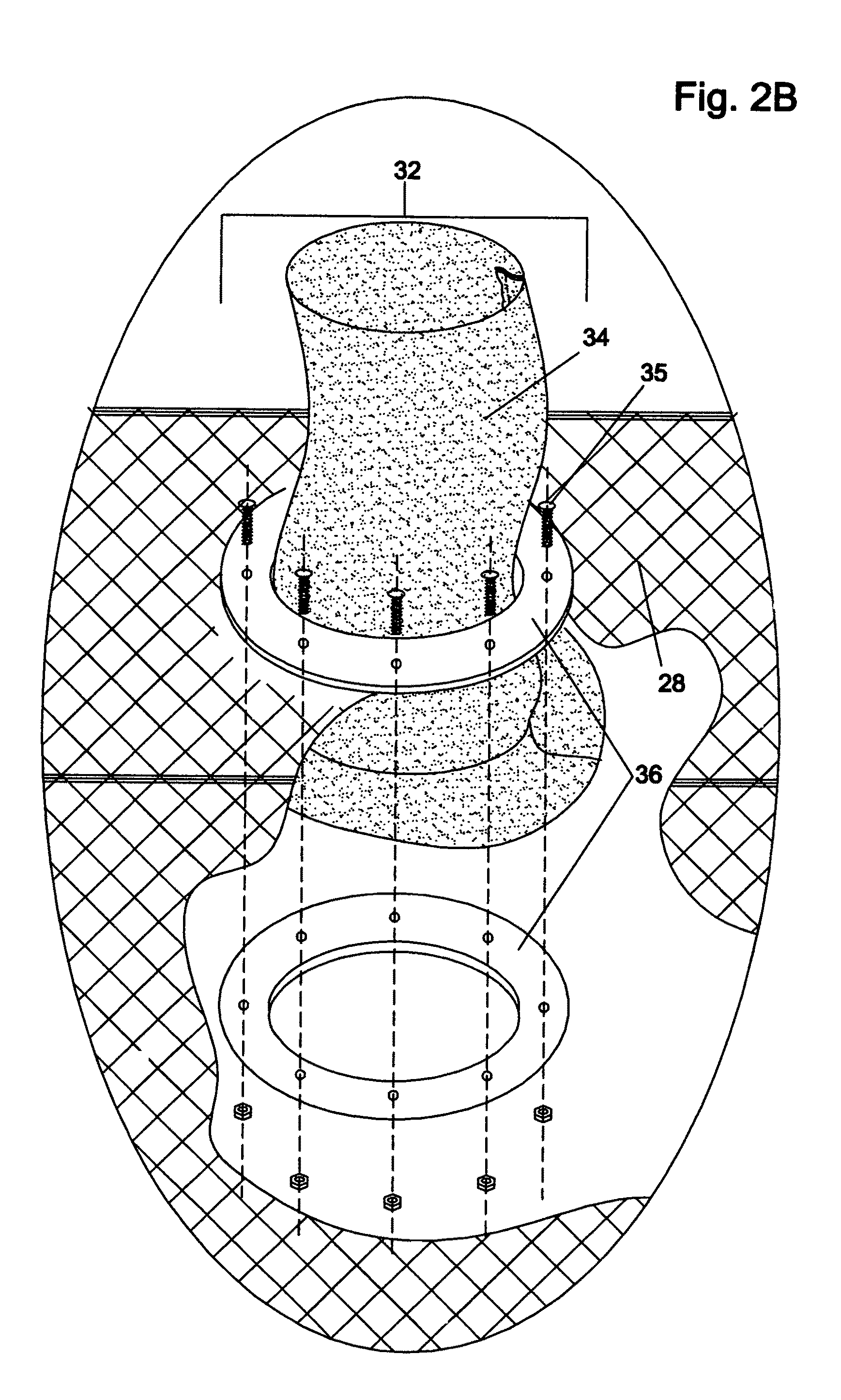 Method of dewatering solids laden liquids utilizing a reusable filter element