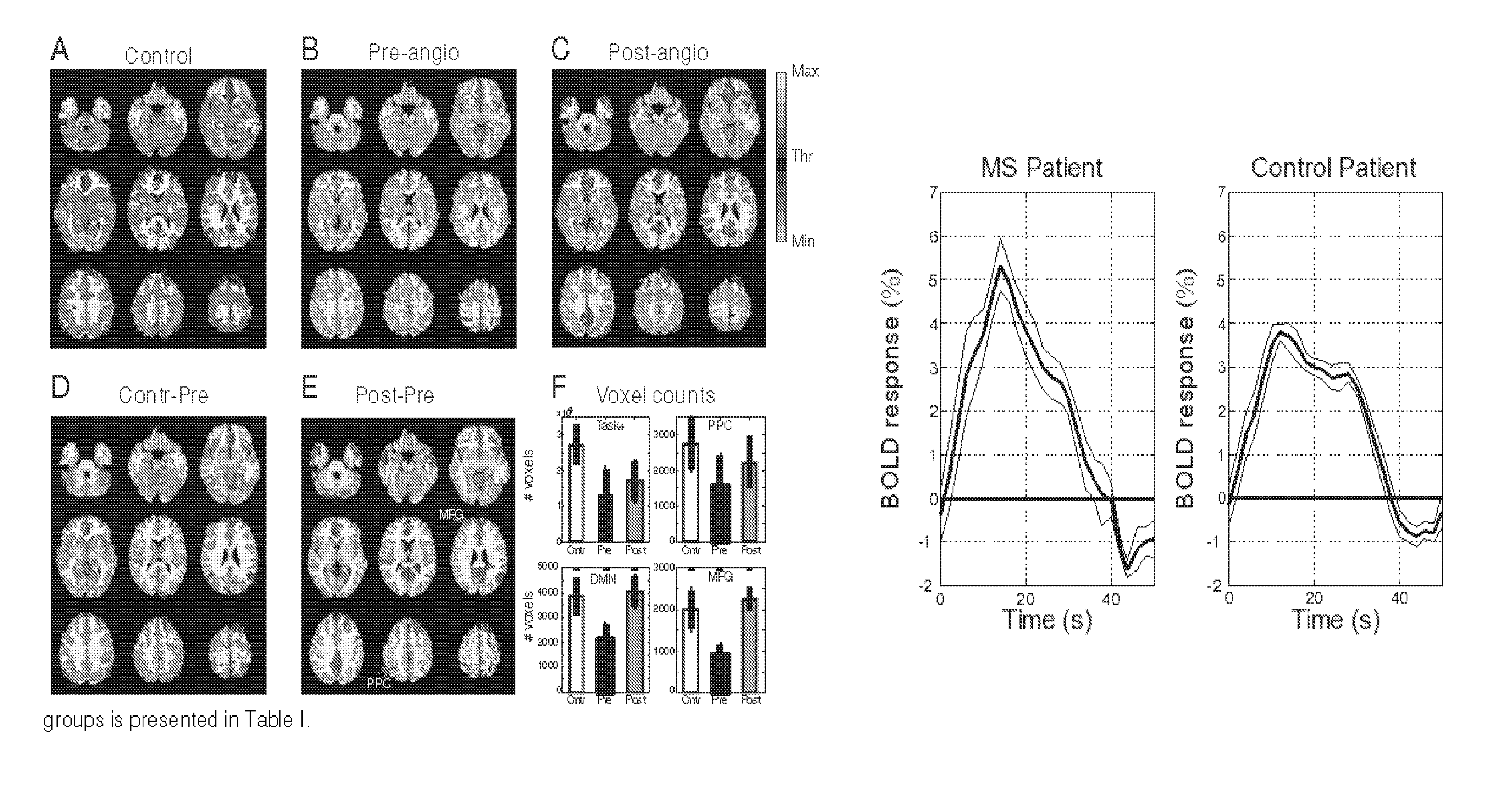 Method to diagnose and measure vascular drainage insufficiency in the central nervous system