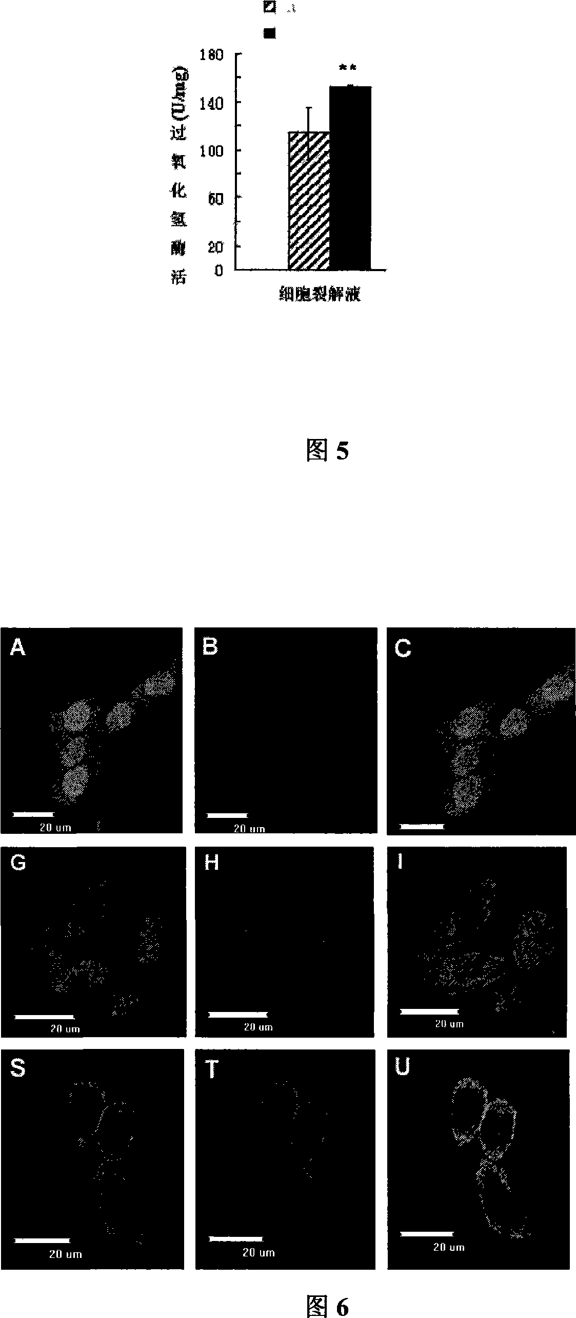 Method for improving secernment efficiency of recombined protein