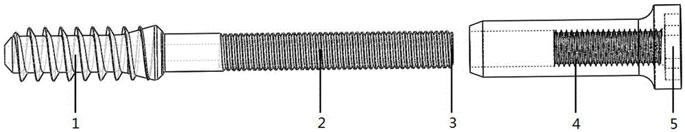 Femoral intramedullary nail device