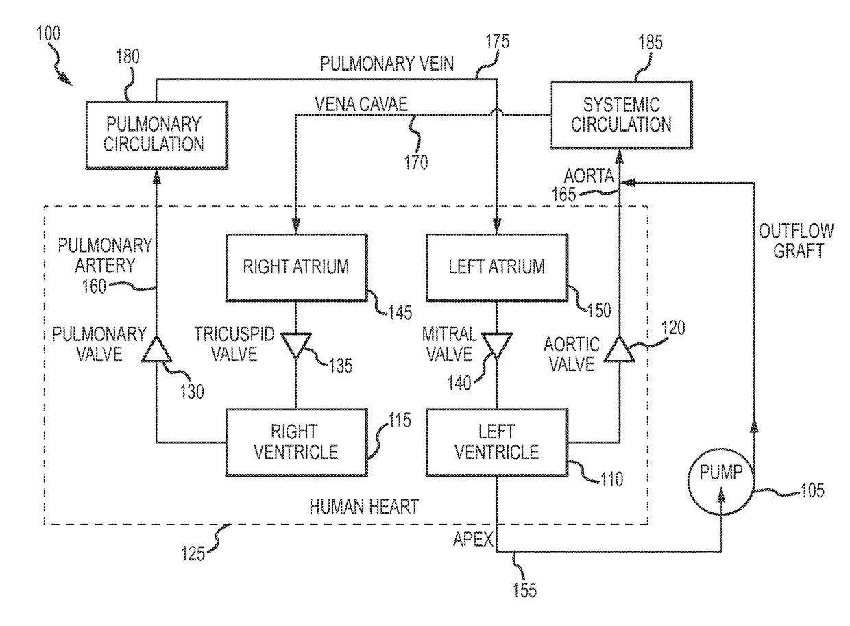 Blood pump and method of suction detection