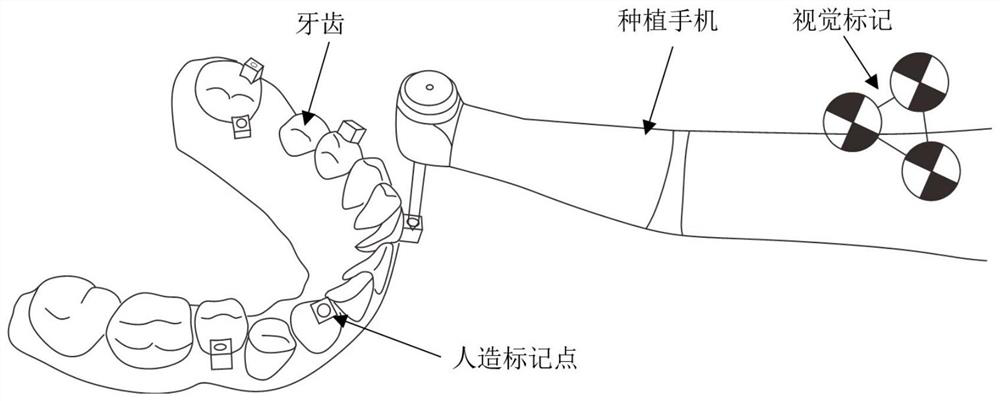 Registration method and system for dental navigation operation