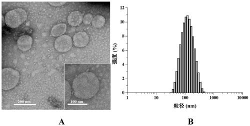 Polypeptide drug-loaded temperature-sensitive liposome and preparation method and application thereof