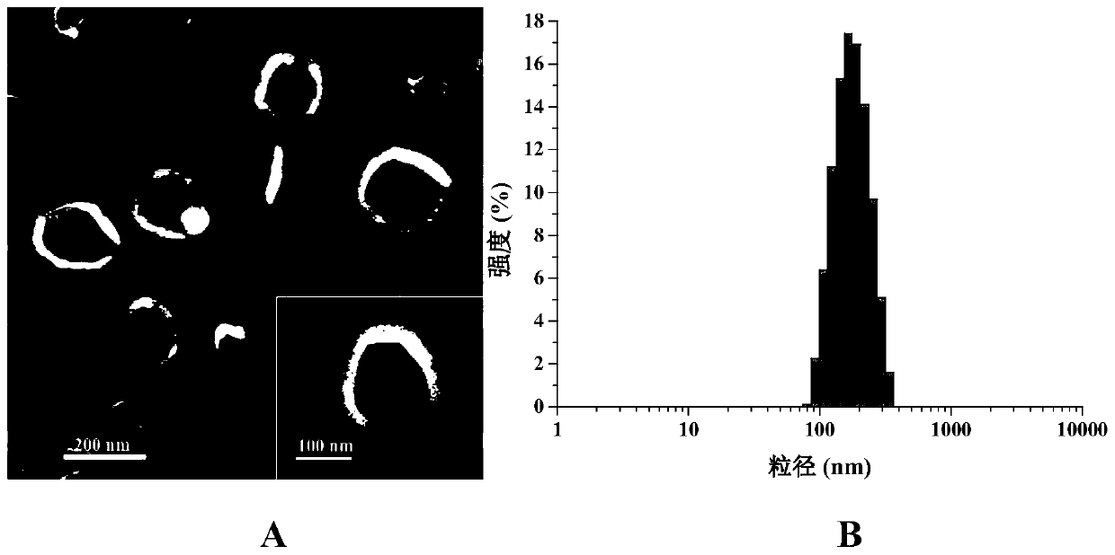 Polypeptide drug-loaded temperature-sensitive liposome and preparation method and application thereof