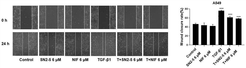 Nifurazide derivatives and their preparation methods and uses