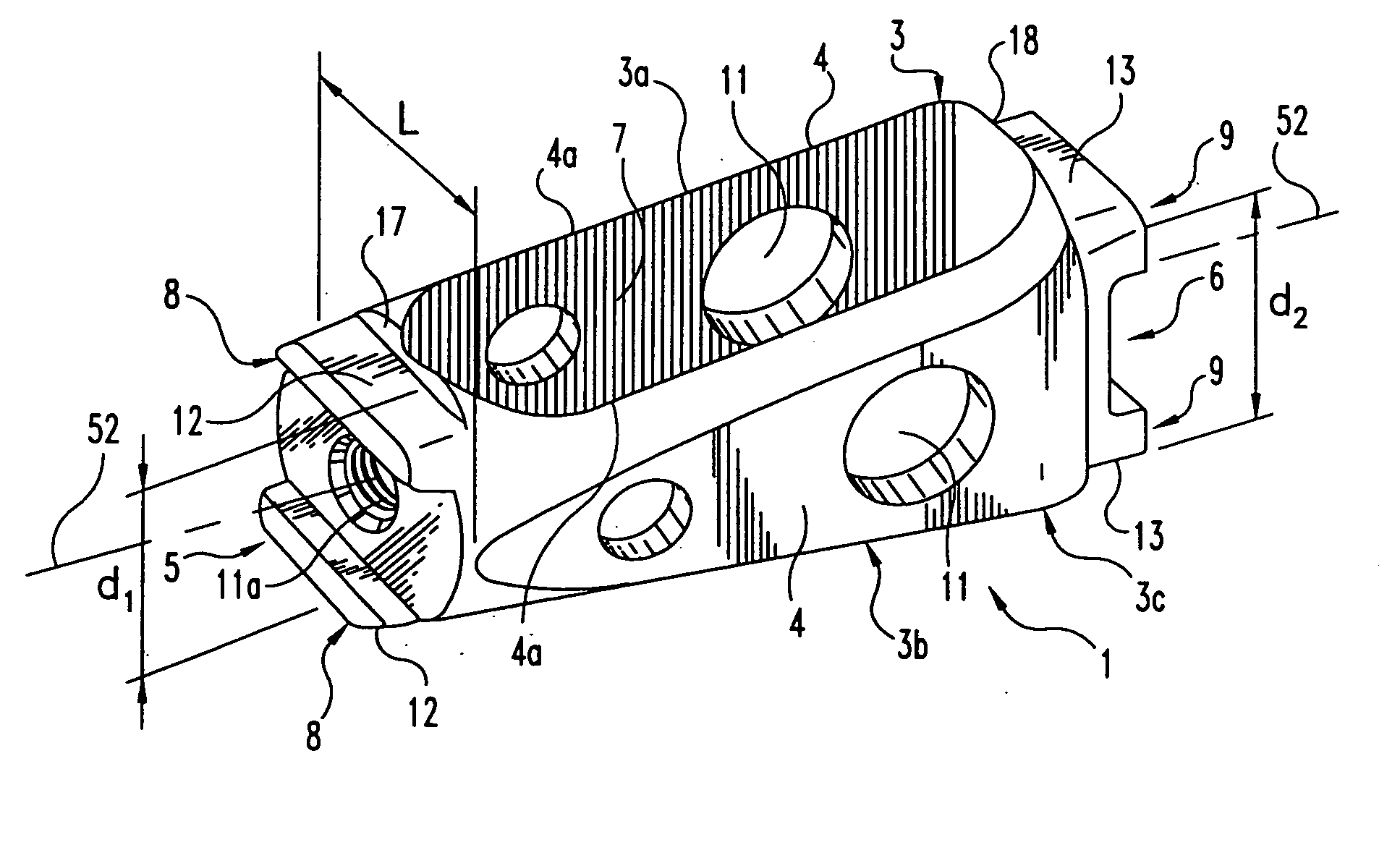 Spinal implant and cutting tool preparation accessory for mounting the implant