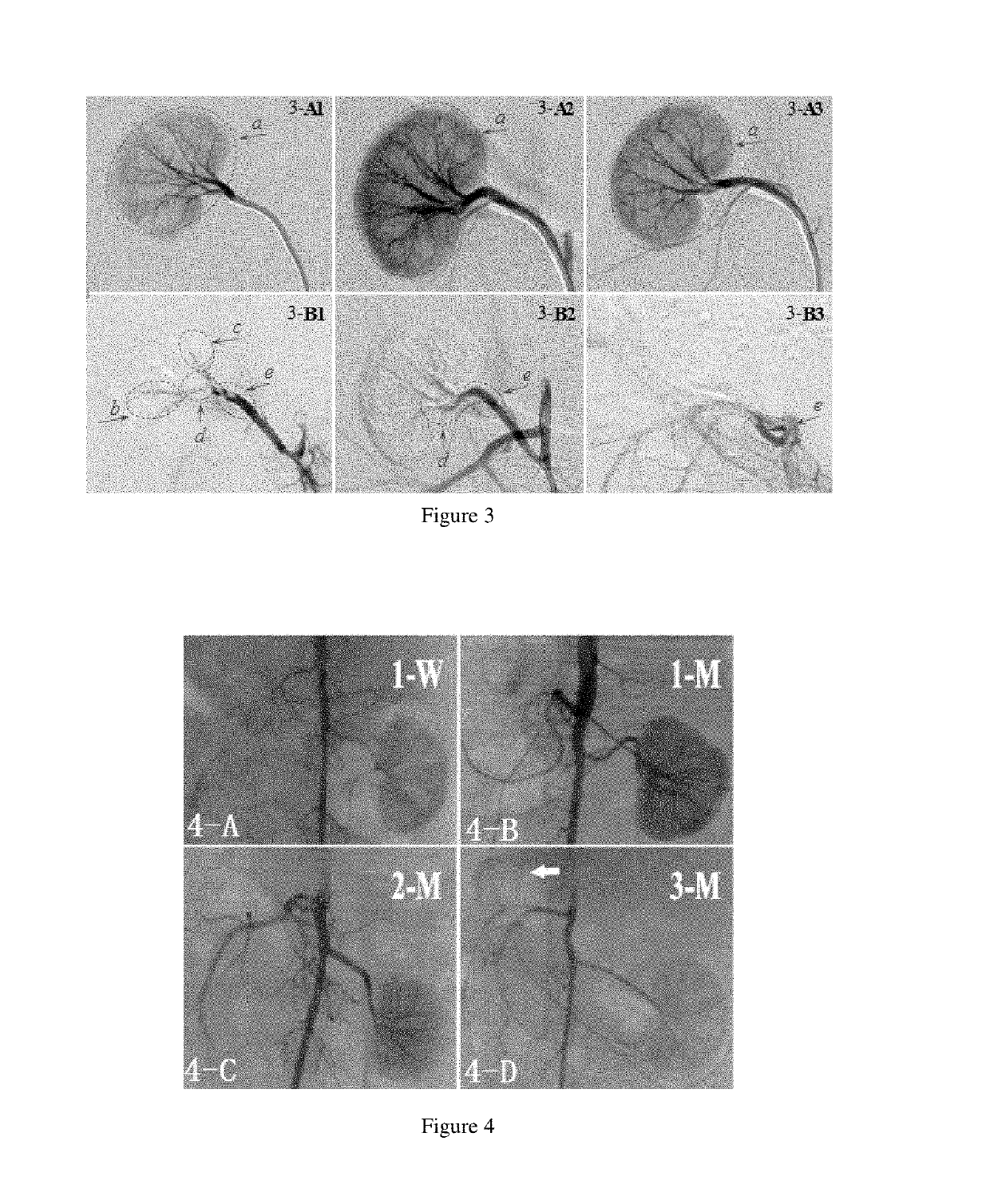 Embolism material for blood vessel, preparation method therefor and use thereof in preparation of drugs