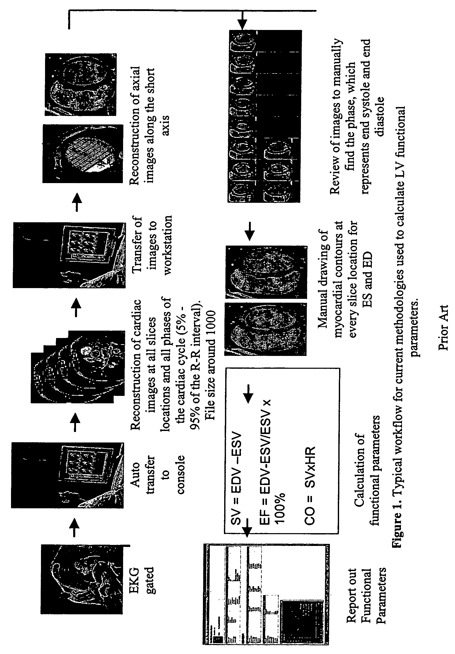 Cardiac display methods and apparatus