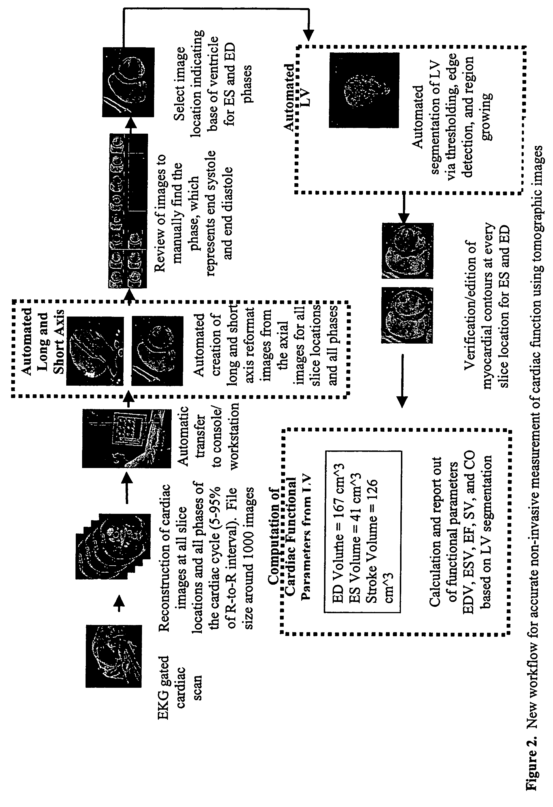 Cardiac display methods and apparatus