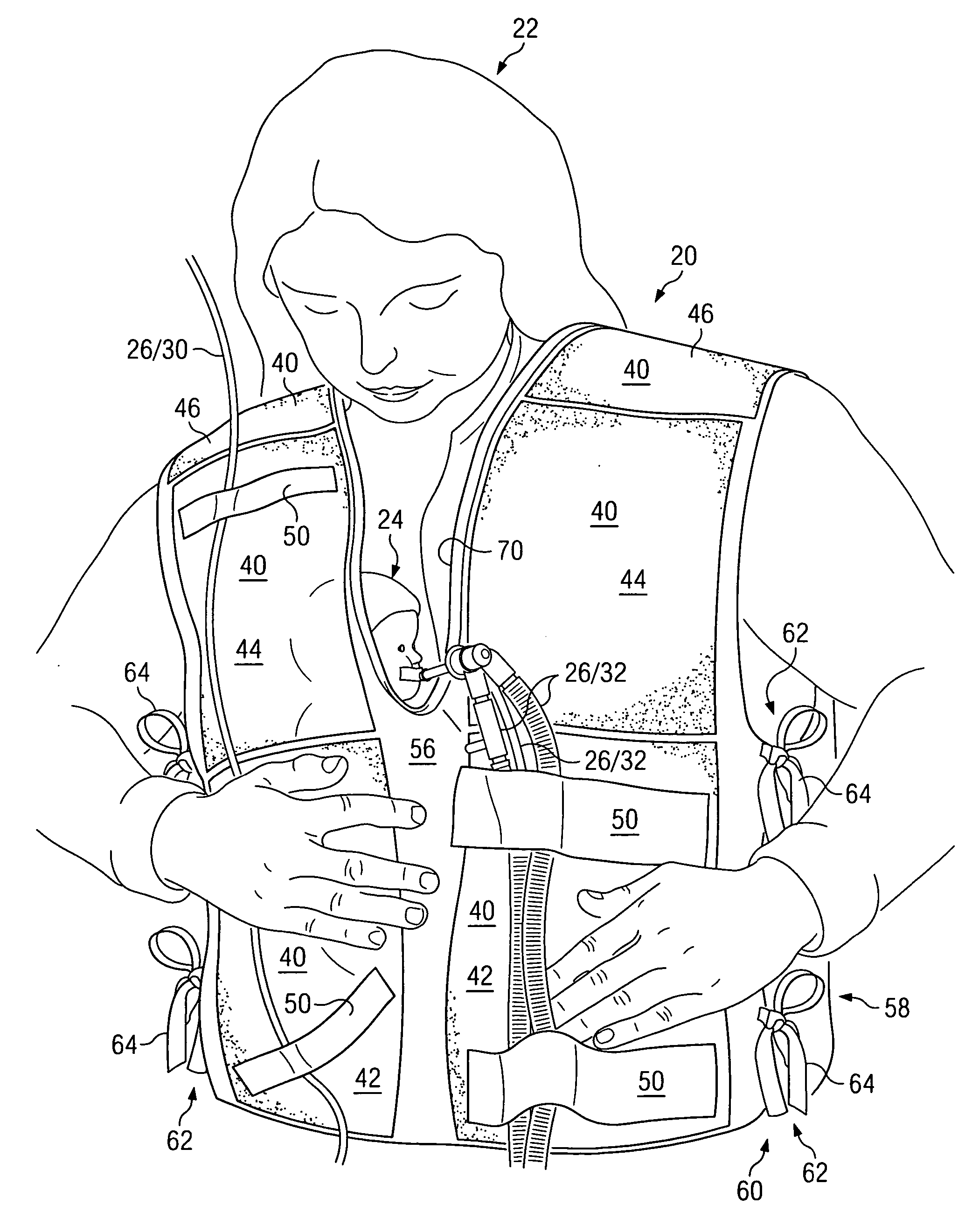 Medical garments for assisting in skin-to-skin holding of infants in neonatal intensive care units