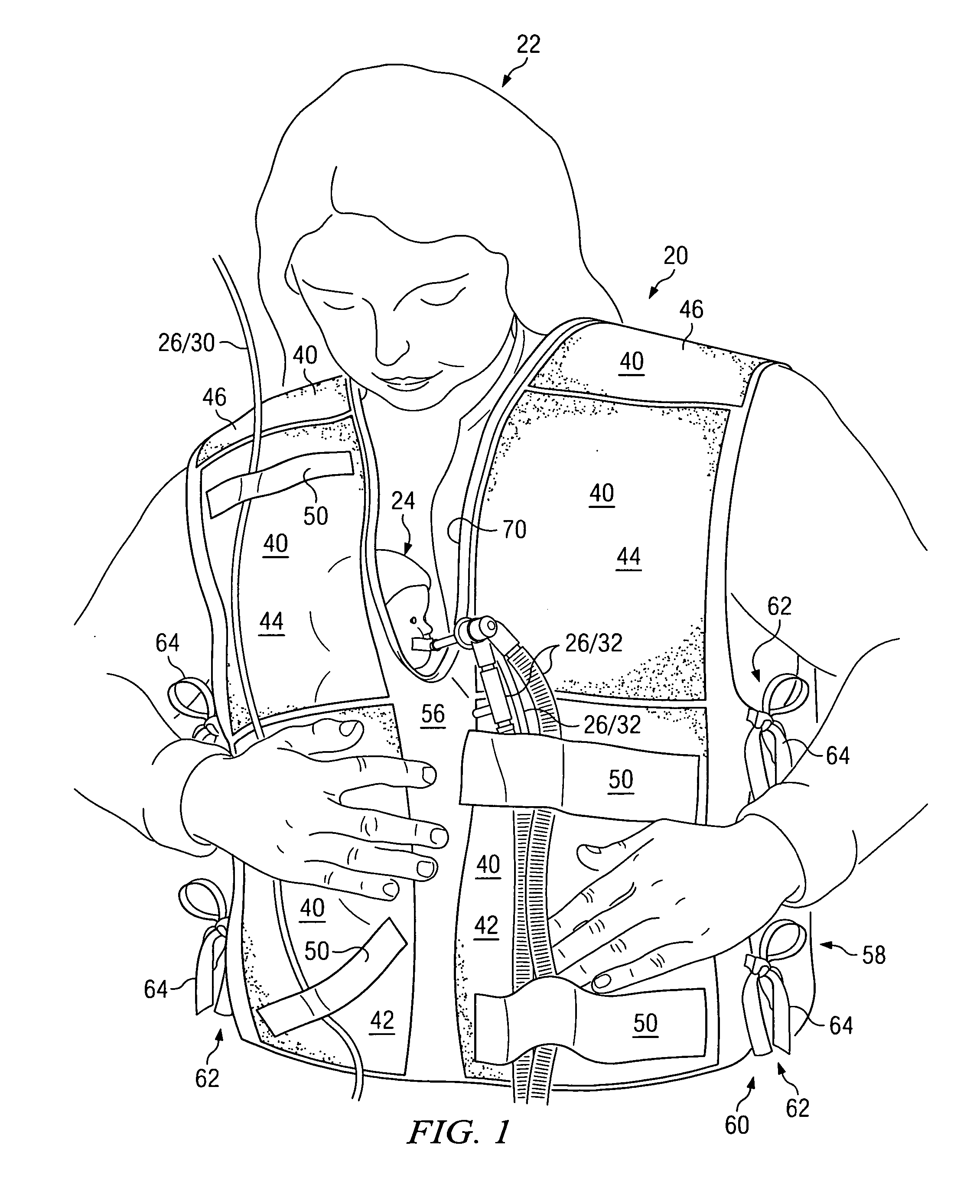 Medical garments for assisting in skin-to-skin holding of infants in neonatal intensive care units