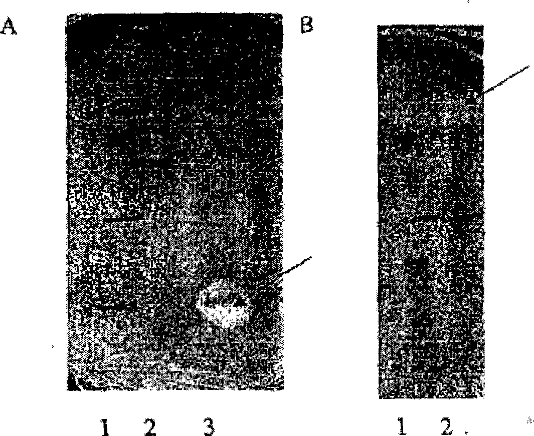 Novel enterococcus and streptococcus strains and bacteriocins