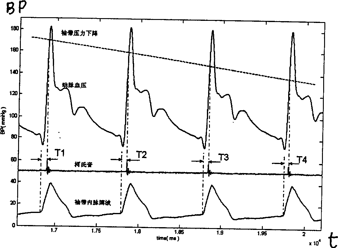 Method for measuring arterial pressure, apparatus and individual correction tech. therefor