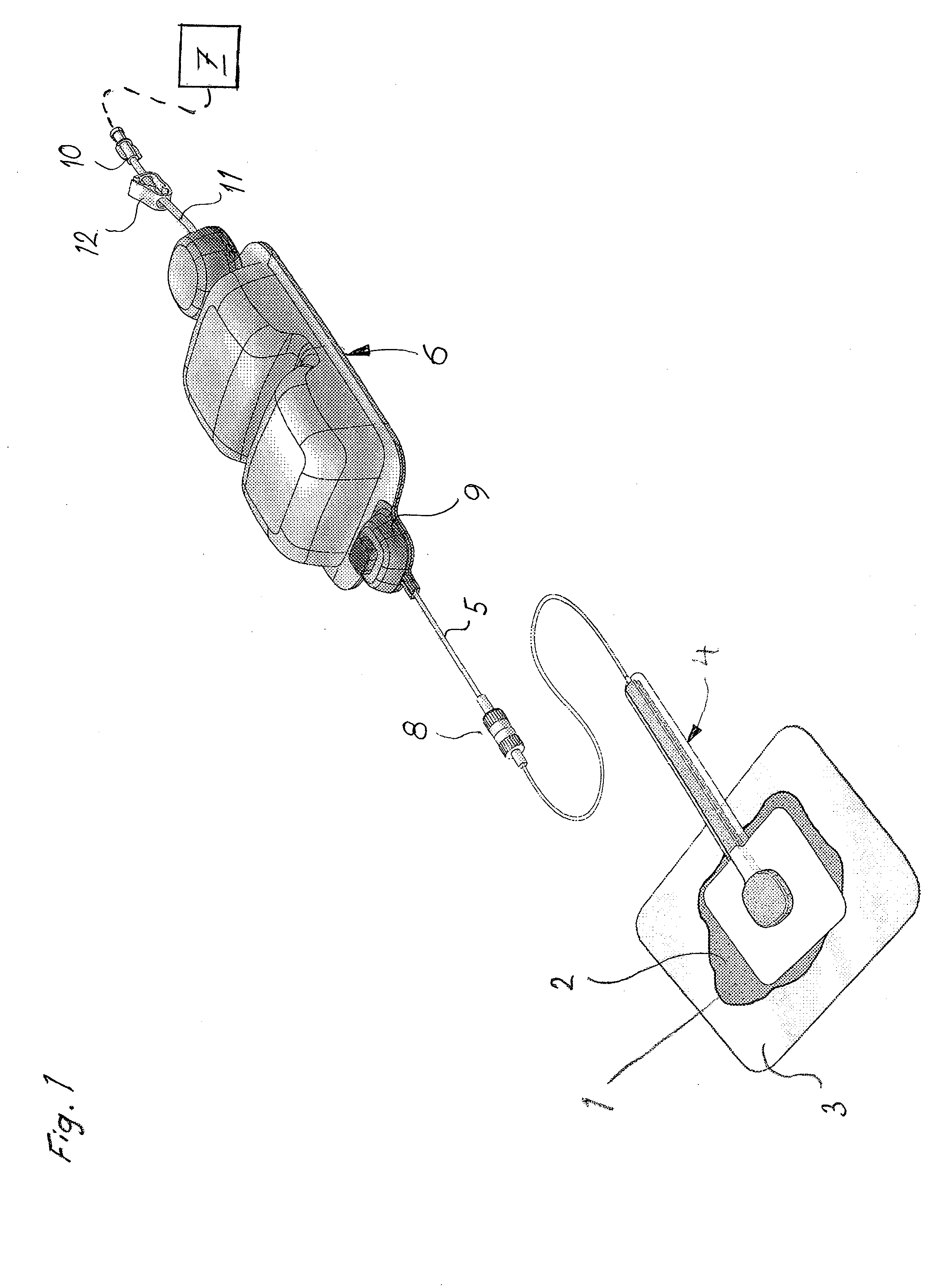 Device for treatment of wounds and a method for manufacturing of wound pads