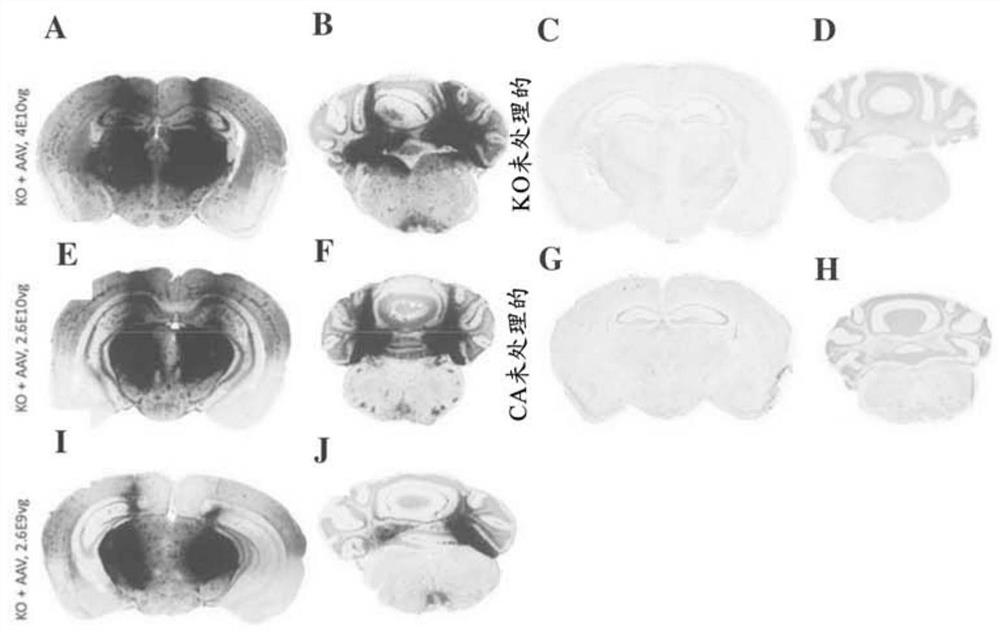 Raav vectors for the treatment of gm1 and gm2 gangliosidosis