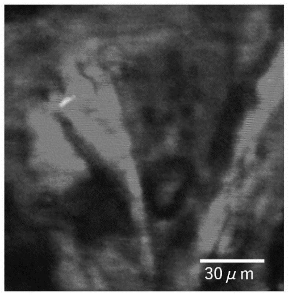 Super-resolution photoacoustic imaging system and method based on saturated absorption effect