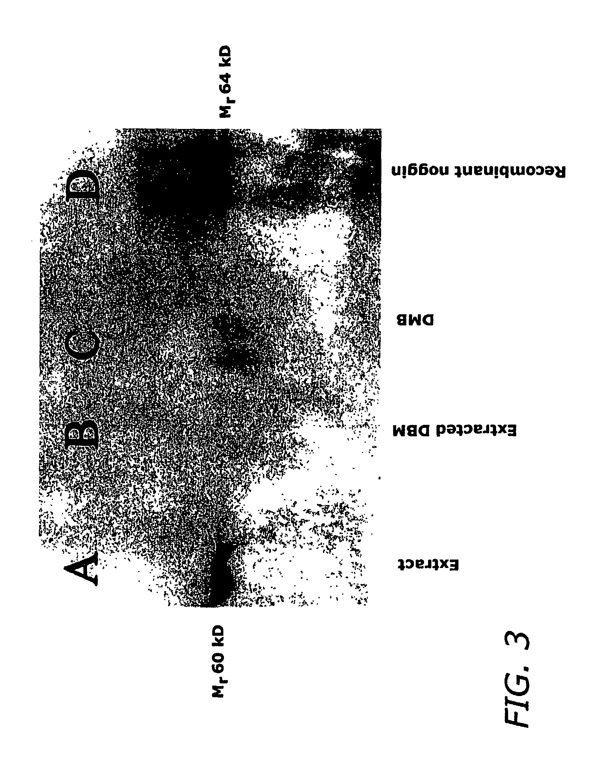 Activating extraction of demineralized bone matrix