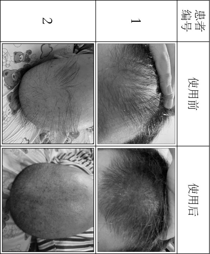 Hair growth cream formula and preparation method thereof