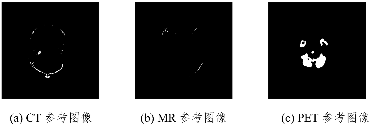 Medical image registration method based on alpha-Renyi mutual information